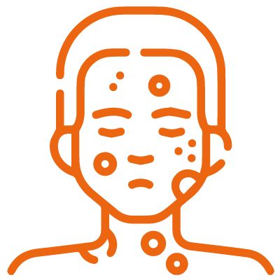 man's head and shoulders covered in spots of shingles